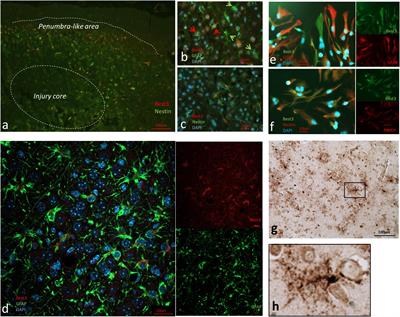 Bestrophin-3 Expression in a Subpopulation of Astrocytes in the Neonatal Brain After Hypoxic-Ischemic Injury